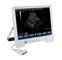 Diagnoseultraschall-System TS20 Digital für Geburtshilfe-und Gynäkologie-Abteilung fournisseur