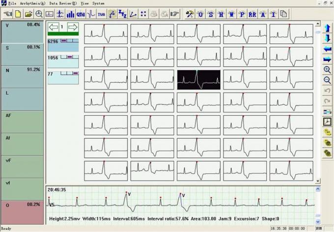 Dynamische ECG Systeme TLC6000 12 Systeme der Führungs-ECG Holter 48 Stunden Recorder-mit Analyse-Software